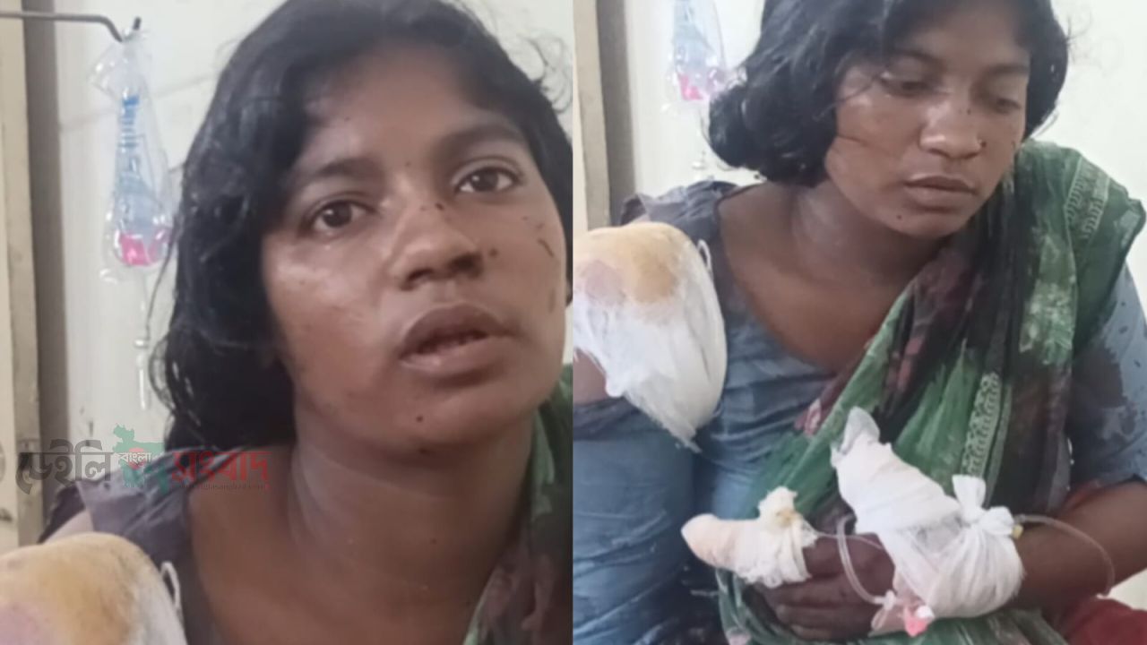 মোল্লাহাটে গৃহবধূকে কুপিয়ে জখমের অভিযোগ, স্বামী পলাতক