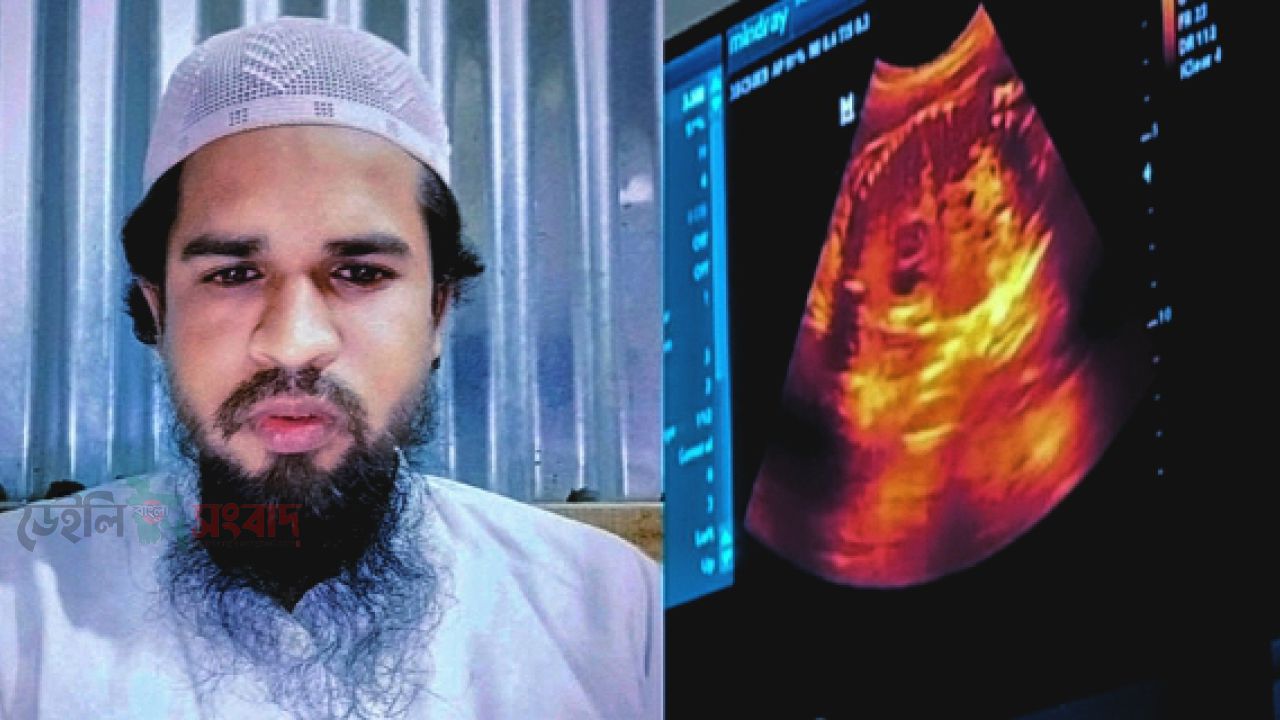 নেত্রকোনায় মাদ্রাসা শিক্ষকের বিরুদ্ধে ১১ বছরের ছাত্রীকে ধর্ষণের অভিযোগ; ৭ মাসের অন্তঃসত্ত্বা, জীবন সংশয়