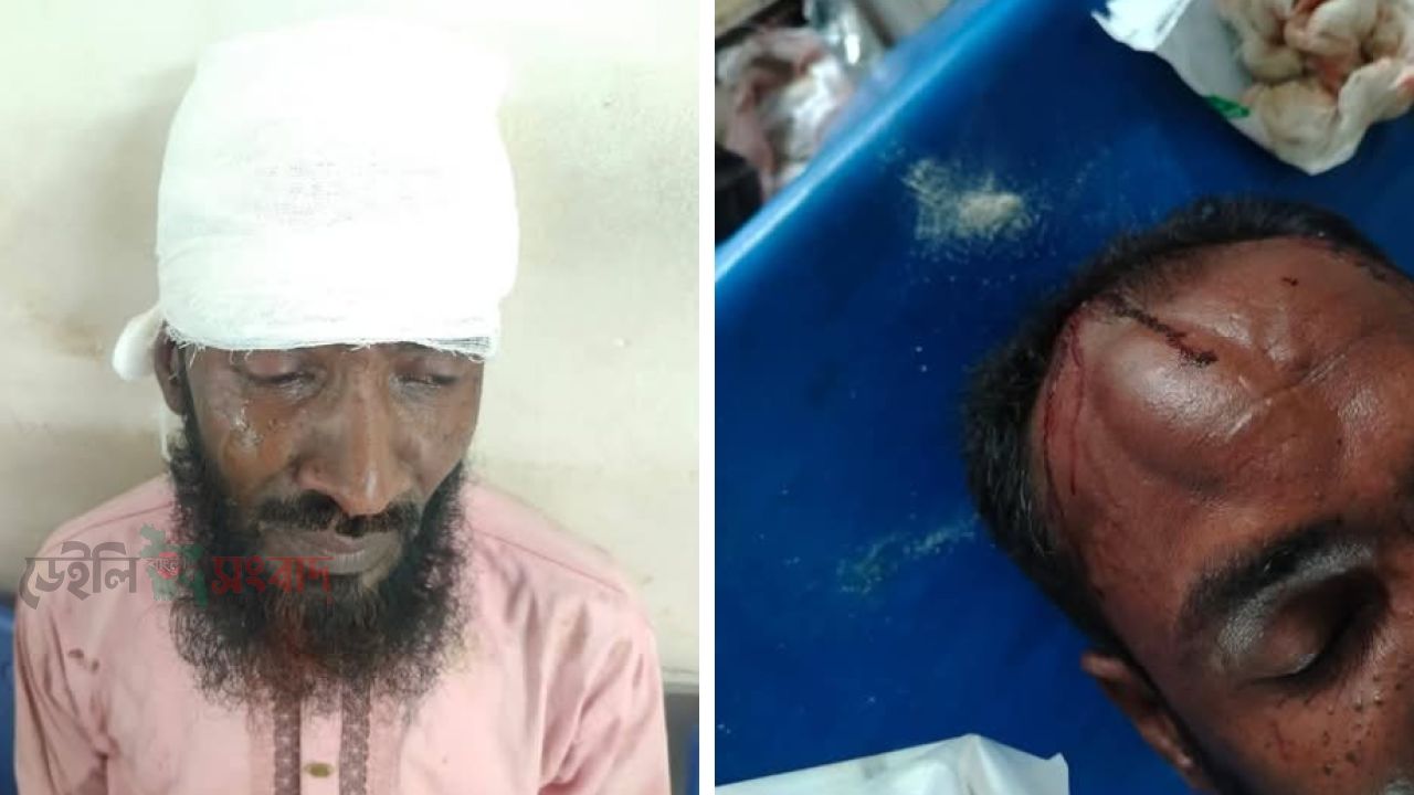 জমি সংক্রান্ত  বিরোধ ও পূর্ব শত্রুতার জারে বাগমারায় বিএনপি নেতাসহ আহত ৮: কুমিল্লা মেডিকেলে ভর্তি