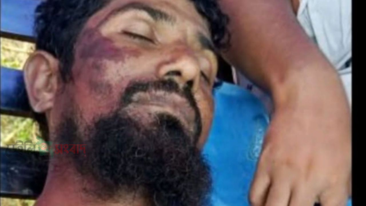 মোল্লাহাটে ঢালাই গাড়ি উল্টে শ্রমিক নিহত