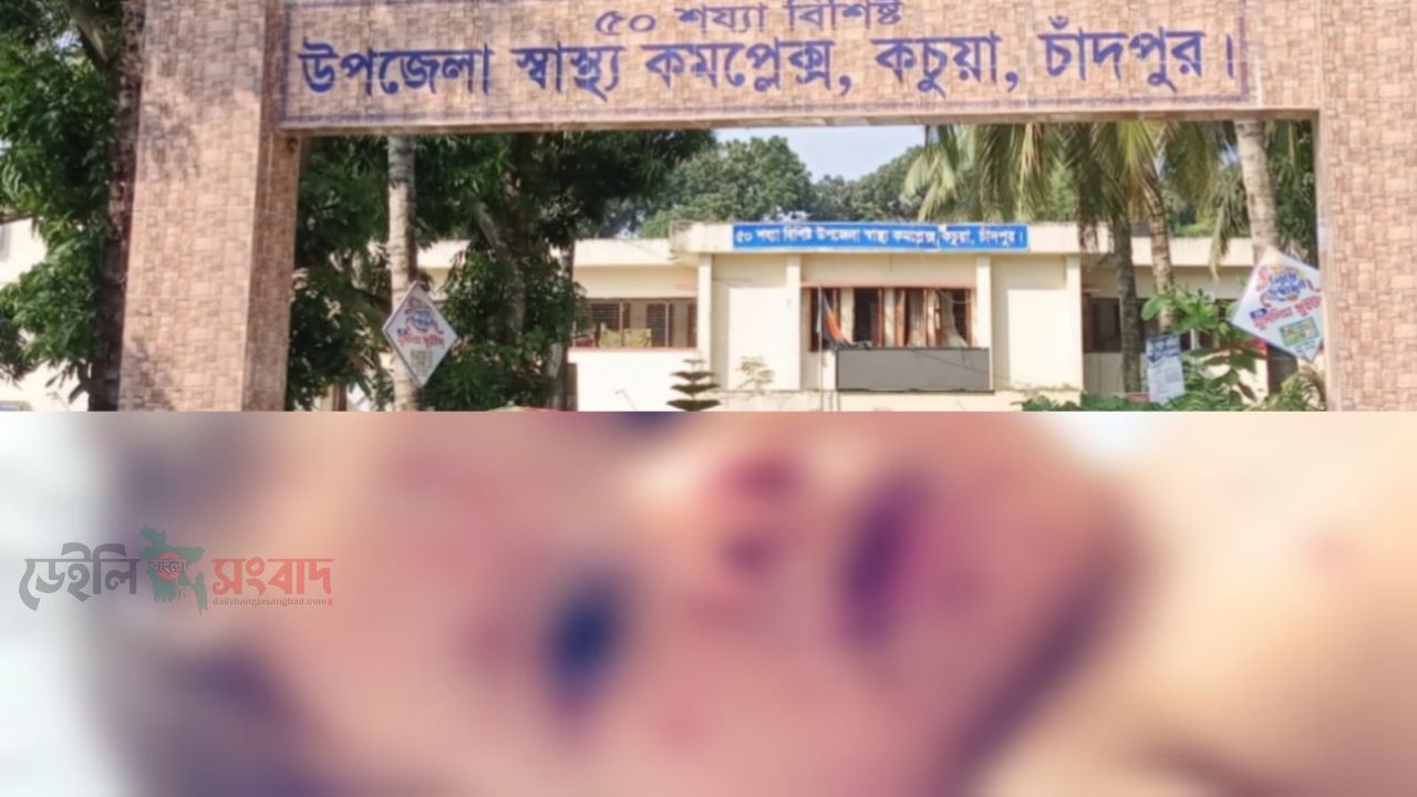 কচুয়ায় স্বাস্থ্য কমপ্লেক্স হামরোগে উপসর্গে ১৩ মাসের ১ শিশুর মৃত্যু
