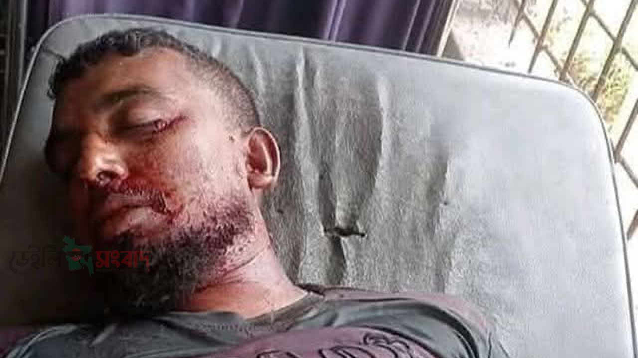 কয়রায় গরুর গাড়ি উল্টে গরু ব্যবসায়ীর মৃ-ত্যু, আ-হত ০৩