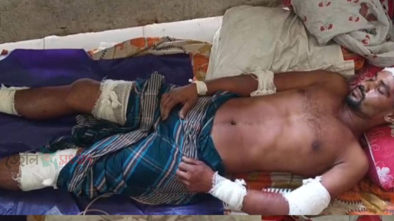 মোল্লাহাটে যুবককে অপহরণ করে কুপিয়ে জখম, আশঙ্কাজনক অবস্থায় হাসপাতালে