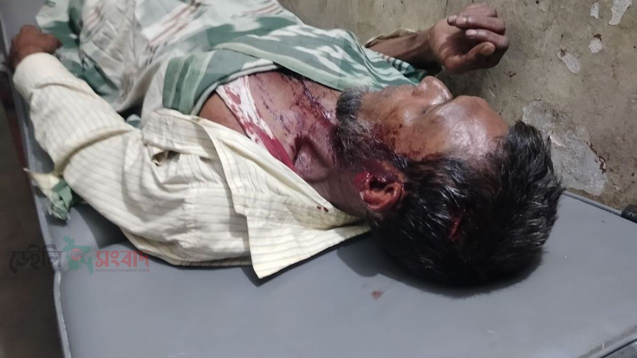 দৌলতপুর পিয়ারপুর গ্রামে বিএনপির অফিসে হামলা ককটেল বিস্ফোরণের অভিযোগ; আহত ৫