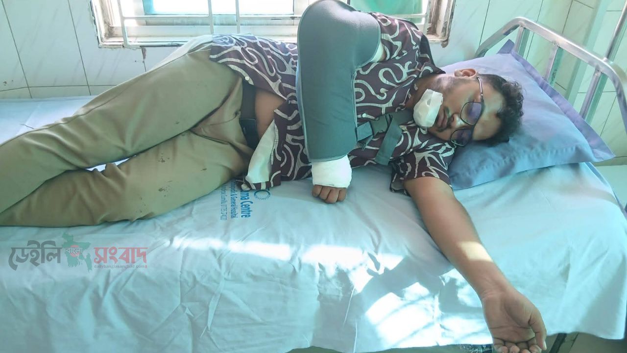 বাইক দুর্ঘটনায় আহত সাংবাদিক খান মোহাম্মদ রুবেল হোসেন, আজ রাতে অপারেশন