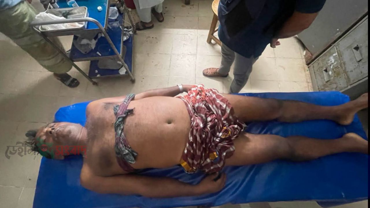 সরাইলে হাওরের মাছের ইজারা নিয়ে রক্তক্ষয়ী সংঘর্ষ: ৫ ঘণ্টার তাণ্ডবে নিহত ১, আহত অর্ধশতাধিক।