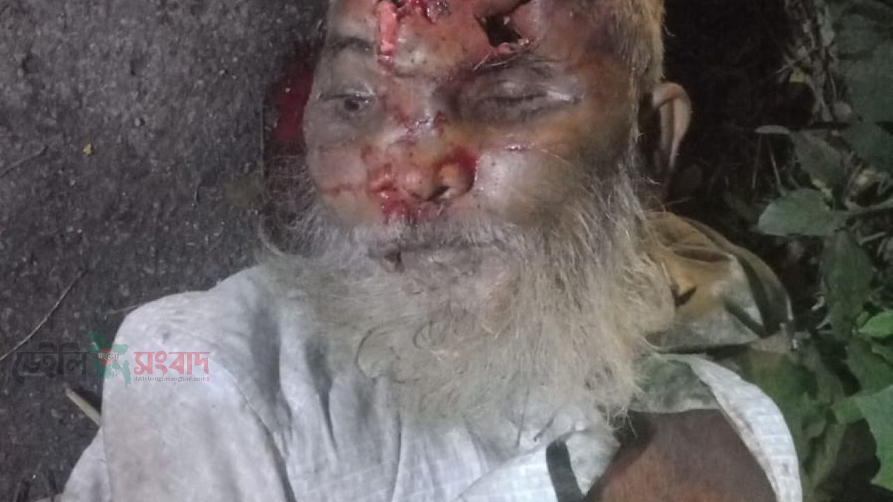 মোল্লাহাটে ঢাকা-খুলনা মহাসড়কে অজ্ঞাত বৃদ্ধ নিহত