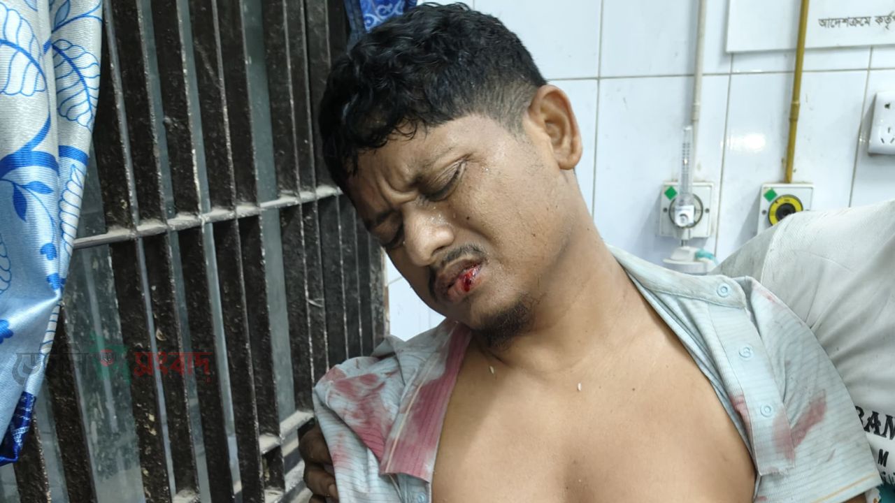 নরসিংদীর পলাশে গুলিবিদ্ধ ২, আ.লীগ নেতাদের বিরুদ্ধে অভিযোগ 