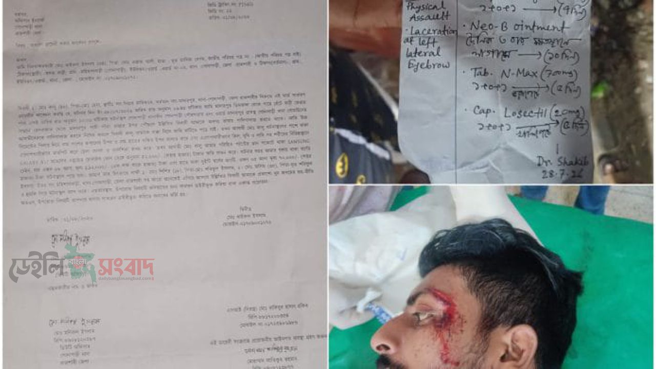 গোদাগাড়ীতে যুবককে পিটিয়ে জখম 