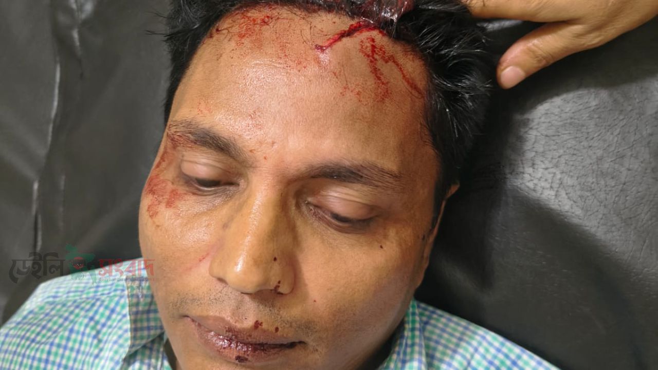 কালিয়াকৈরে সংবাদ সংগ্রহ করার সময় এস এ  টিভির উপজেলা প্রতিনিধি সহ আহত ২
