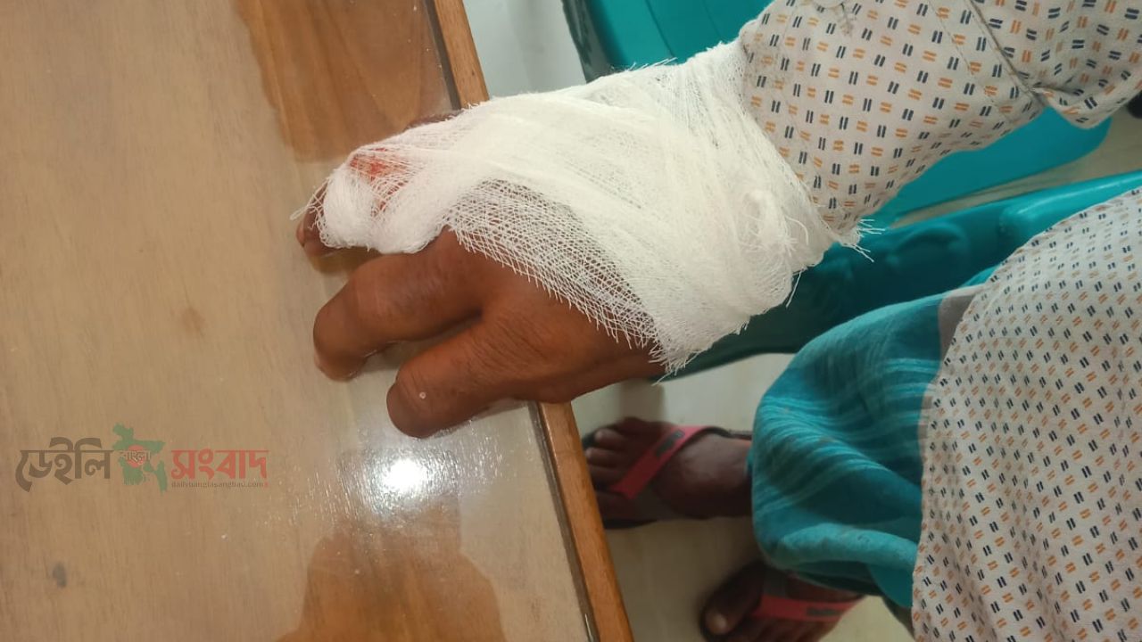 সরিষাবাড়ীতে জমি নিয়ে বিরোধে হামলা, আহত ৪