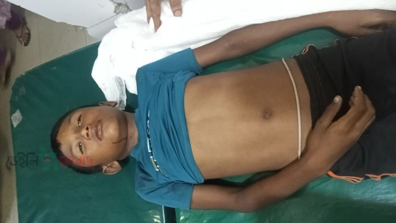 সুনামগঞ্জের গৌরারংয়ে অটোরিকশার ধাক্কায় এক স্কুল শিক্ষার্থীর মৃত্যু