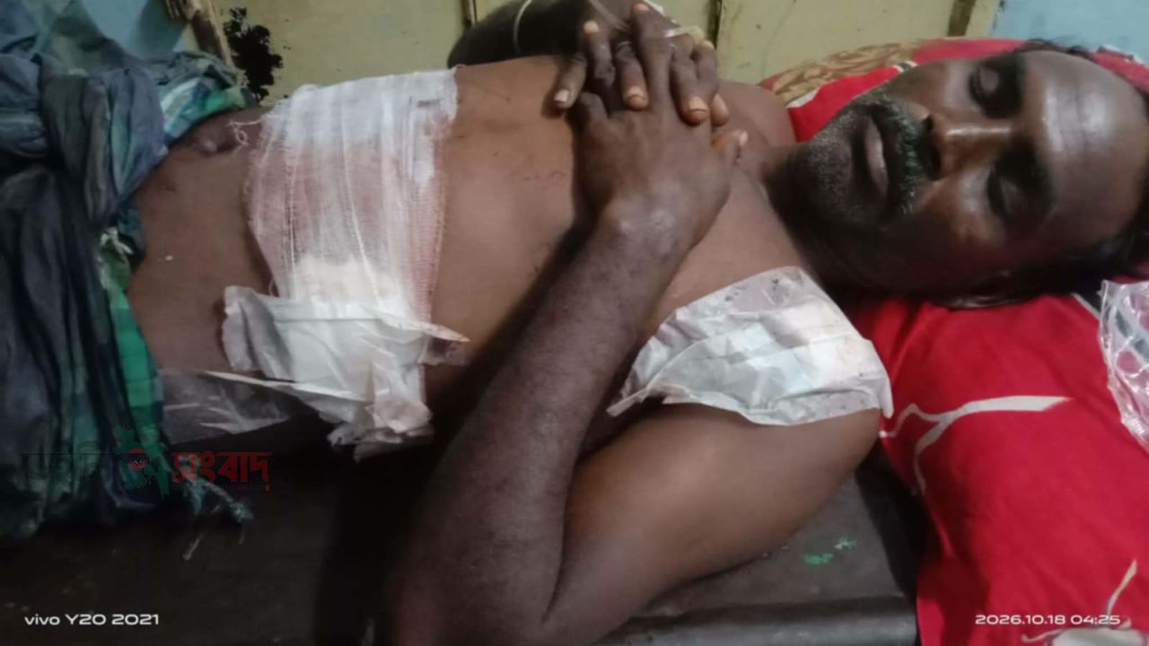 সরিষাবাড়ীতে সবজি বিক্রেতাকে হত্যাচেষ্টার অভিযোগ, হাসপাতালে মৃত্যুর সঙ্গে পাঞ্জা লড়ছেন