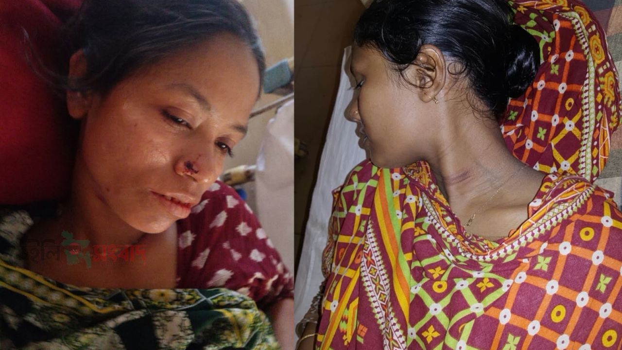 পীরগাছায় অন্তঃসত্ত্বা নারীসহ চারজনকে পিটিয়ে জখমের অভিযোগ,৩ দিনেও মামলা নেয়নি পুলিশ!